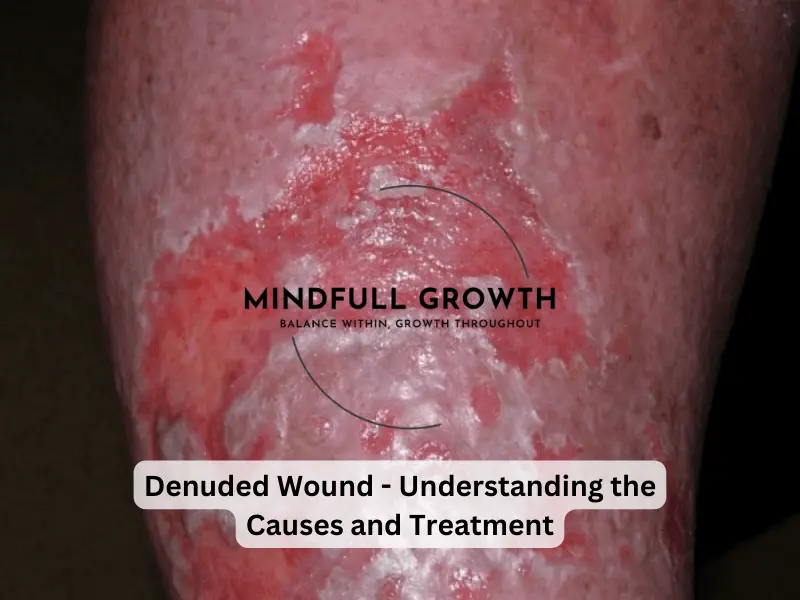 Denuded Wound